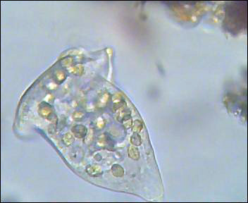 Due ciliati: Vorticella e .....